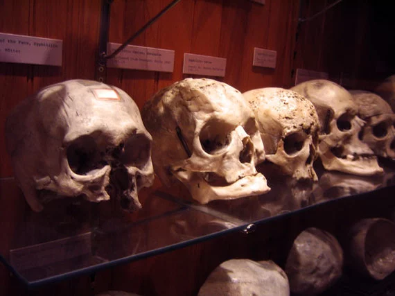 5 Museum Paling Menyeramkan di Dunia