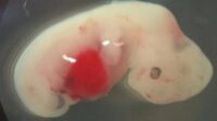 Embrio babi dan Manusia