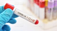 Timbulkan Penyakit Aneh, AstraZeneca Hentikan Uji Coba Vaksin Covid-19
